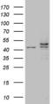 Casein Kinase 1 Epsilon antibody, LS-C338879, Lifespan Biosciences, Western Blot image 