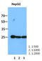 RAS Like Proto-Oncogene A antibody, MBS200231, MyBioSource, Western Blot image 