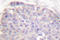 Caspase Recruitment Domain Family Member 6 antibody, LS-C175941, Lifespan Biosciences, Immunohistochemistry paraffin image 