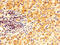 Transglutaminase 2 antibody, CSB-PA11809A0Rb, Cusabio, Immunohistochemistry paraffin image 