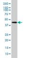 Heat Shock Transcription Factor Family, X-Linked 2 antibody, H00051402-M01, Novus Biologicals, Western Blot image 