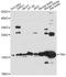 KRAB Box Domain Containing 4 antibody, A16357, Boster Biological Technology, Western Blot image 