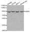 Inhibitor Of Nuclear Factor Kappa B Kinase Subunit Epsilon antibody, LS-C330861, Lifespan Biosciences, Western Blot image 