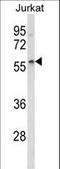 Sprouty Related EVH1 Domain Containing 1 antibody, LS-B10673, Lifespan Biosciences, Western Blot image 