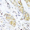 Interferon Lambda 3 antibody, LS-C334190, Lifespan Biosciences, Immunohistochemistry paraffin image 