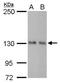 Rho/Rac Guanine Nucleotide Exchange Factor 18 antibody, MA5-27826, Invitrogen Antibodies, Western Blot image 