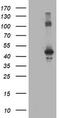 CCM2 Scaffold Protein antibody, M01908, Boster Biological Technology, Western Blot image 