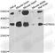 Laforin antibody, A7007, ABclonal Technology, Western Blot image 