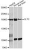Clathrin Heavy Chain antibody, A12423, ABclonal Technology, Western Blot image 