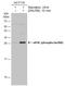 Eukaryotic Translation Initiation Factor 4E antibody, GTX133606, GeneTex, Western Blot image 