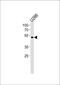 ETS Variant 6 antibody, PA5-35371, Invitrogen Antibodies, Western Blot image 