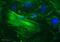 Myosin VIIA antibody, ab3481, Abcam, Immunofluorescence image 