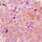 Protein Kinase D2 antibody, LS-C368476, Lifespan Biosciences, Immunohistochemistry paraffin image 