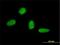 C22 antibody, H00121340-M01, Novus Biologicals, Immunocytochemistry image 