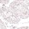 Plasmalemma Vesicle Associated Protein antibody, PA5-51698, Invitrogen Antibodies, Immunohistochemistry paraffin image 