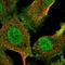 E3 ubiquitin-protein ligase RNF8 antibody, HPA064925, Atlas Antibodies, Immunocytochemistry image 