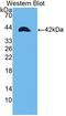 Tropomyosin 2 antibody, LS-C726564, Lifespan Biosciences, Western Blot image 