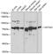 UDP Glycosyltransferase Family 3 Member A2 antibody, GTX66500, GeneTex, Western Blot image 