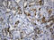 Centrosomal Protein 72 antibody, M08305, Boster Biological Technology, Immunohistochemistry paraffin image 