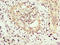 N-Myristoyltransferase 1 antibody, LS-C670243, Lifespan Biosciences, Immunohistochemistry paraffin image 