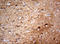 NUMB Endocytic Adaptor Protein antibody, LS-C336475, Lifespan Biosciences, Immunohistochemistry paraffin image 