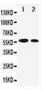 Cyclin Dependent Kinase Inhibitor 1C antibody, PA1876, Boster Biological Technology, Western Blot image 