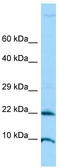 Adenosine Deaminase TRNA Specific 2 antibody, TA331369, Origene, Western Blot image 