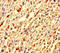 GEM Interacting Protein antibody, LS-C678102, Lifespan Biosciences, Immunohistochemistry paraffin image 