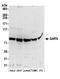 Glutaminyl-TRNA Synthetase antibody, A304-752A, Bethyl Labs, Western Blot image 
