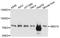 Bardet-Biedl Syndrome 10 antibody, A06733, Boster Biological Technology, Western Blot image 