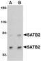 SATB Homeobox 2 antibody, orb75001, Biorbyt, Western Blot image 