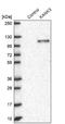 KN Motif And Ankyrin Repeat Domains 3 antibody, NBP2-14138, Novus Biologicals, Western Blot image 