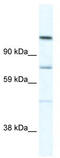 Ras-associating and dilute domain-containing protein antibody, TA329628, Origene, Western Blot image 