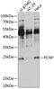 PEST Proteolytic Signal Containing Nuclear Protein antibody, 15-527, ProSci, Western Blot image 
