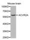 Activin A Receptor Type 2A antibody, abx001614, Abbexa, Western Blot image 