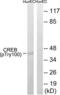 CAMP Responsive Element Binding Protein 1 antibody, LS-C198840, Lifespan Biosciences, Western Blot image 