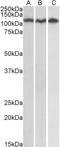 ADAM Metallopeptidase Domain 17 antibody, LS-B4437, Lifespan Biosciences, Western Blot image 