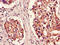 Proteasome Subunit Beta 5 antibody, orb46792, Biorbyt, Immunohistochemistry paraffin image 