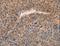 ADAM Like Decysin 1 antibody, LS-C404453, Lifespan Biosciences, Immunohistochemistry paraffin image 