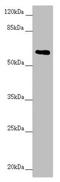 Ard1 antibody, LS-C676640, Lifespan Biosciences, Western Blot image 