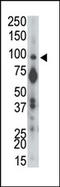 Protein Tyrosine Phosphatase Receptor Type A antibody, AP15220PU-N, Origene, Western Blot image 