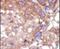 ACK1 antibody, PA5-14765, Invitrogen Antibodies, Immunohistochemistry paraffin image 