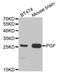 Placental Growth Factor antibody, orb136070, Biorbyt, Western Blot image 