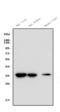 Eukaryotic Translation Initiation Factor 2B Subunit Alpha antibody, A04239-1, Boster Biological Technology, Western Blot image 