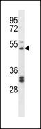 Prostaglandin I2 Receptor antibody, LS-C162275, Lifespan Biosciences, Western Blot image 