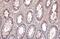 Galectin 3 antibody, GTX635156, GeneTex, Immunohistochemistry paraffin image 