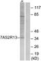 Taste 2 Receptor Member 13 antibody, A12309, Boster Biological Technology, Western Blot image 