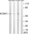 Potassium Voltage-Gated Channel Subfamily A Member 1 antibody, LS-B7133, Lifespan Biosciences, Western Blot image 