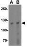 Ankyrin Repeat And LEM Domain Containing 2 antibody, GTX17159, GeneTex, Western Blot image 