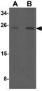 Myc target protein 1 antibody, GTX32092, GeneTex, Western Blot image 